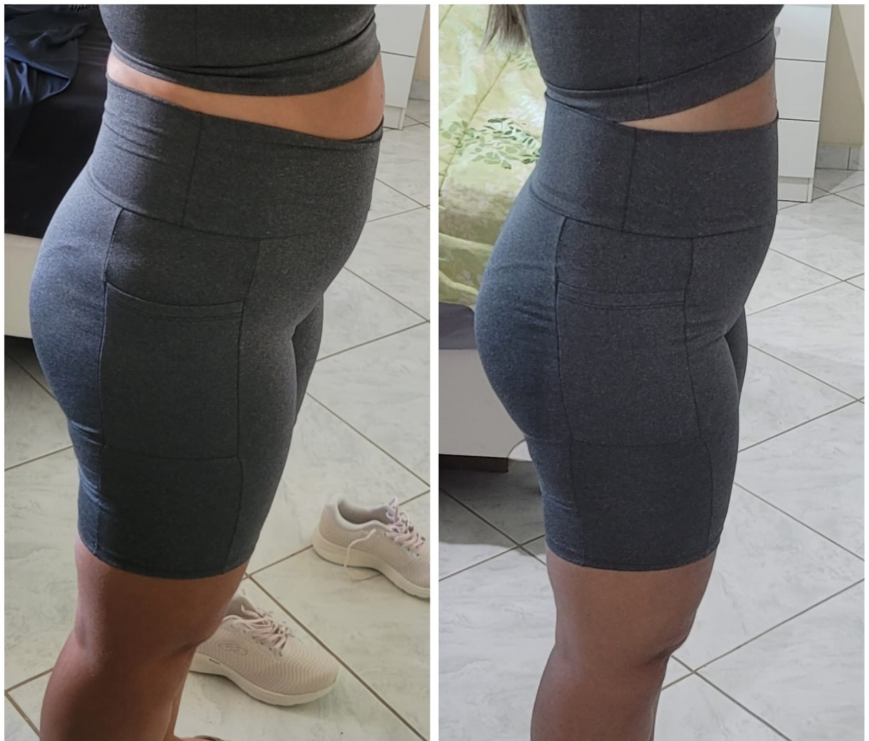 Antes e Depois - Evolução Corporal